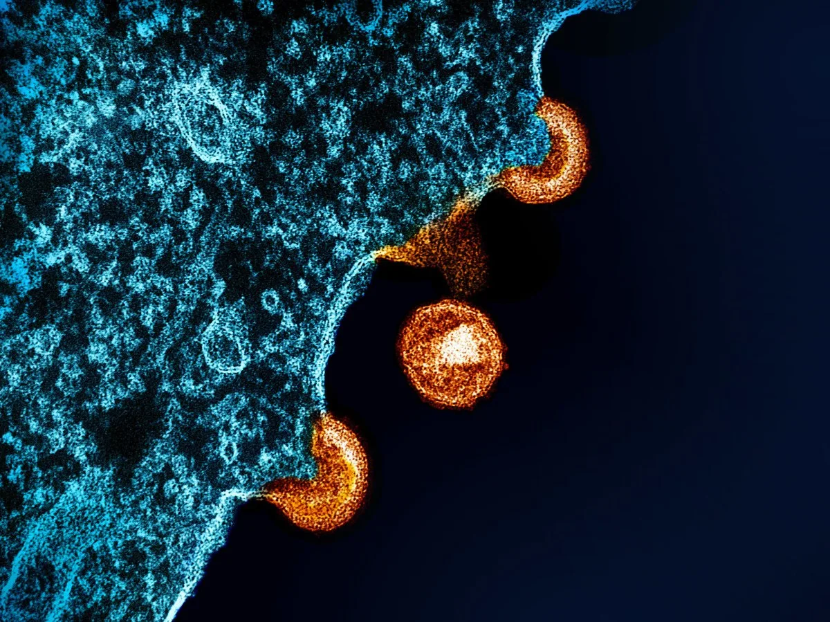 Αντίγραφα του HIV (κίτρινο) εξέρχονται από μολυσμένα ανθρώπινα κύτταρα σε εικόνα ηλεκτρονικού μικροσκοπίου (NIH)